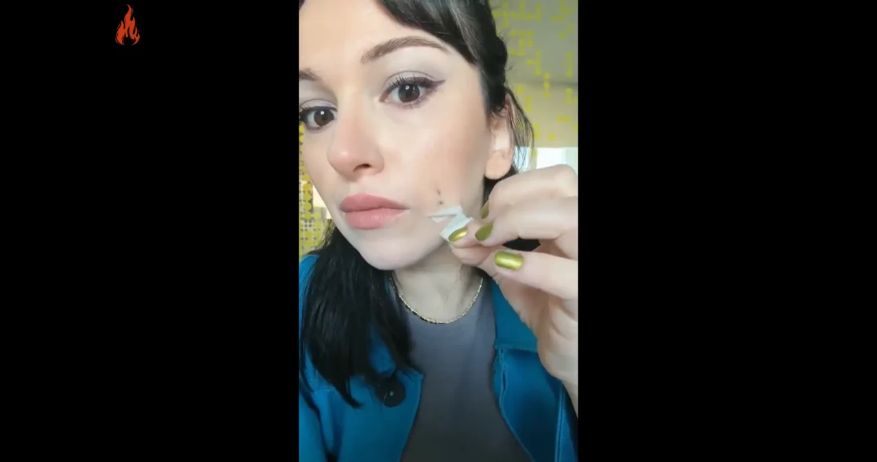 Gamzeplasti Ameliyatı Nedir? Sosyal Medyada Viral Olan Trend