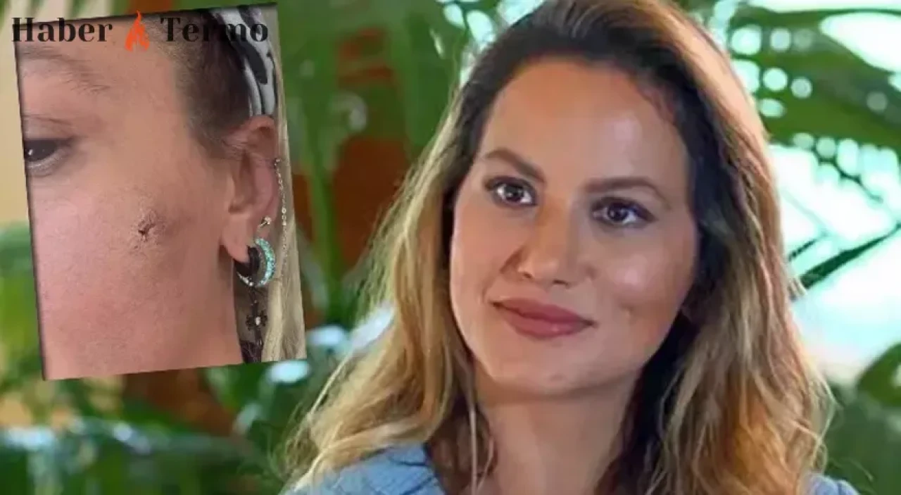 Yıldız Asyalı Şiddet İddiası: Eşinden Darp Edildiğini Açıkladı