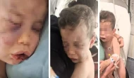 Denizli Sarayköy'de Annesinin sevgilisi, 2 yaşındaki bebeği öldüresiye dövdü!
