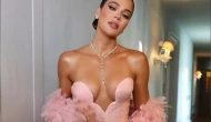 Khloe Kardashian ne yaptırdıysa açıkladı! Estetik listesi olay oldu!