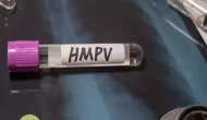 Güney Kıbrıs'ta 4 HMPV vakası tespit edildiği bildirildi!