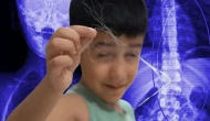 Şırnak'ta 3 Yaşındaki Çocuğun Vücudunda 3 Yıl Sonra 18 cm Kateter Bulundu!