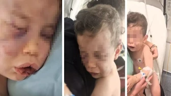 Denizli Sarayköy'de Annesinin sevgilisi, 2 yaşındaki bebeği öldüresiye dövdü!