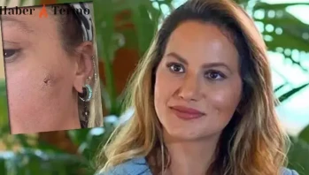 Yıldız Asyalı Şiddet İddiası: Eşinden Darp Edildiğini Açıkladı