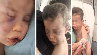 Denizli Sarayköy'de Annesinin sevgilisi, 2 yaşındaki bebeği öldüresiye dövdü!