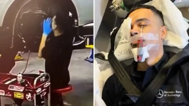 Otomobil Tamirhanesinde Korkunç Kaza: İşçinin Gözüne Tornavida Saplandı!