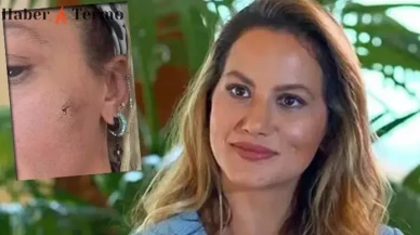 Yıldız Asyalı Şiddet İddiası: Eşinden Darp Edildiğini Açıkladı