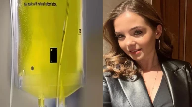 Oyuncu Gizem Güven’den Tepki Çeken Sarı Serum Paylaşımı!