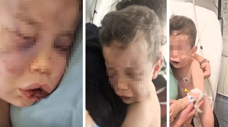 Denizli Sarayköy'de Annesinin sevgilisi, 2 yaşındaki bebeği öldüresiye dövdü!