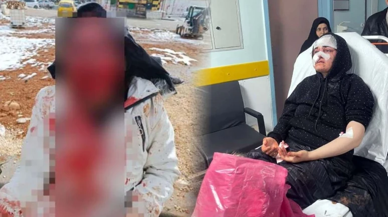 Gaziantep'te Koca Dehşeti: Adliye Yolunda Eşini Taşla Öldüresiye Dövdü